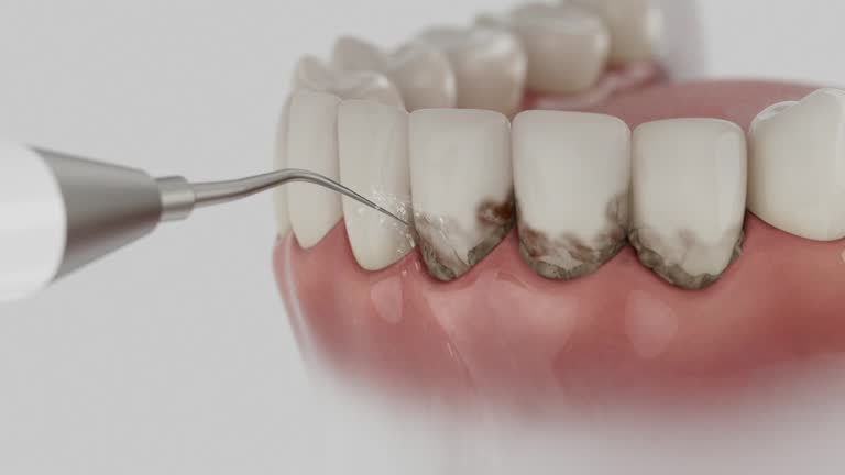Reliable Dental Implants contractor in Oakes, ND by Smile Center Dentistry